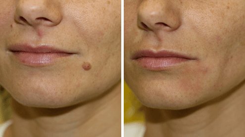 Perfection Cosmetic Laser & Aesthetic Clinic - جروف كلوز - Perfection Cosmetic Laser & Aesthetic Clinic - Grove Close