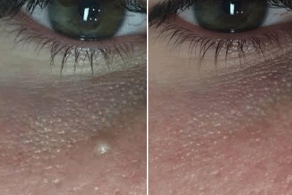 Perfection Cosmetic Laser & Aesthetic Clinic - جروف كلوز - Perfection Cosmetic Laser & Aesthetic Clinic - Grove Close