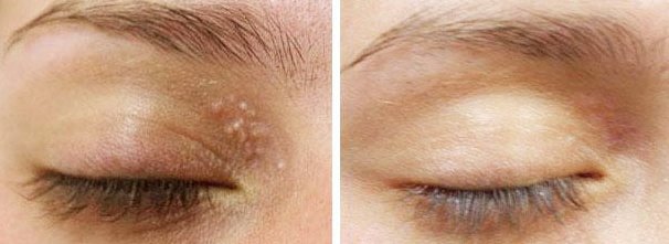 Perfection Cosmetic Laser & Aesthetic Clinic - جروف كلوز - Perfection Cosmetic Laser & Aesthetic Clinic - Grove Close