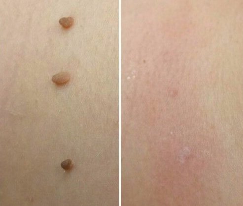 Perfection Cosmetic Laser & Aesthetic Clinic - جروف كلوز - Perfection Cosmetic Laser & Aesthetic Clinic - Grove Close