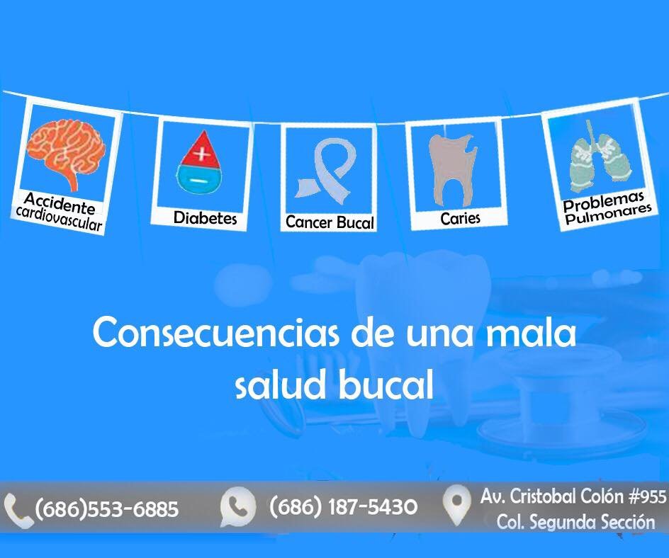 Perioimplant - Perioimplant