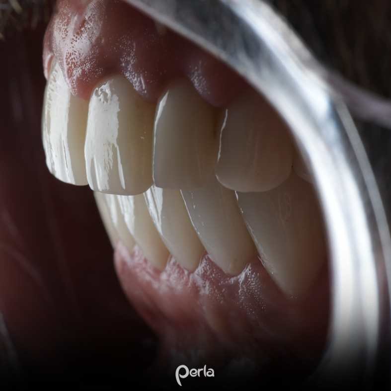 Perla Dental Centre - Perla Dental Centre