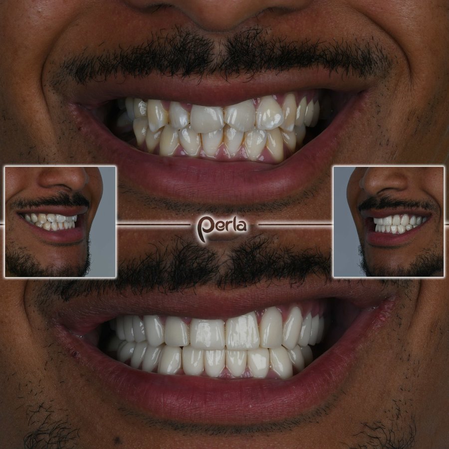 Perla Dental Centre - Perla Dental Centre