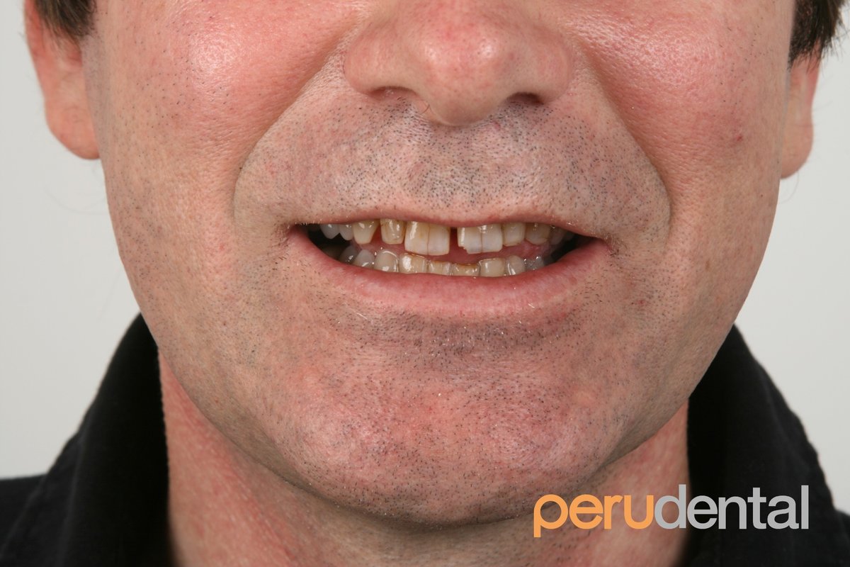 Peru Dental - Peru Dental