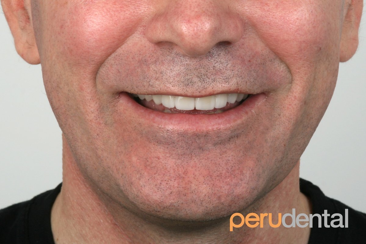 Peru Dental - Peru Dental