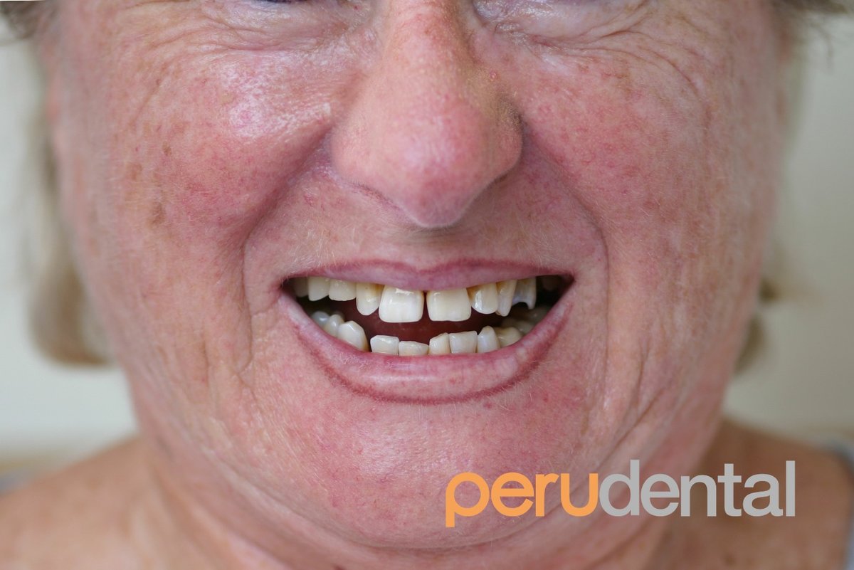 Peru Dental - Peru Dental