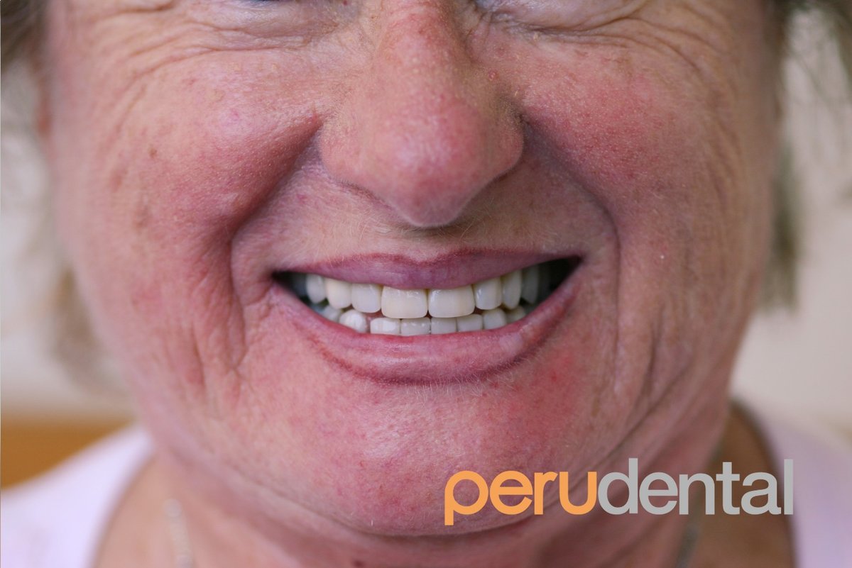 Peru Dental - Peru Dental