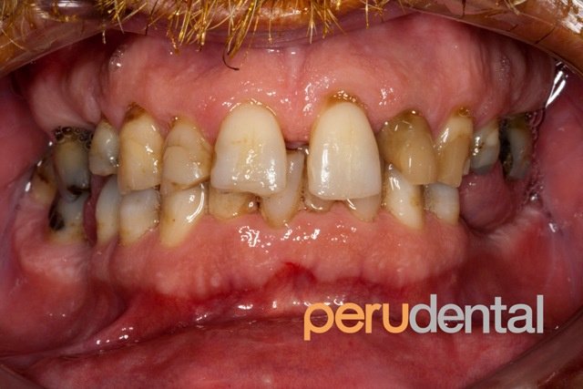 Peru Dental - Peru Dental