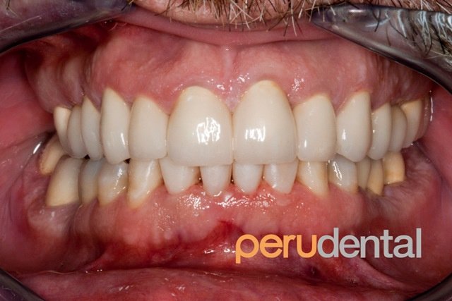 Peru Dental - Peru Dental