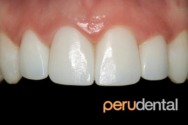 Peru Dental - Peru Dental
