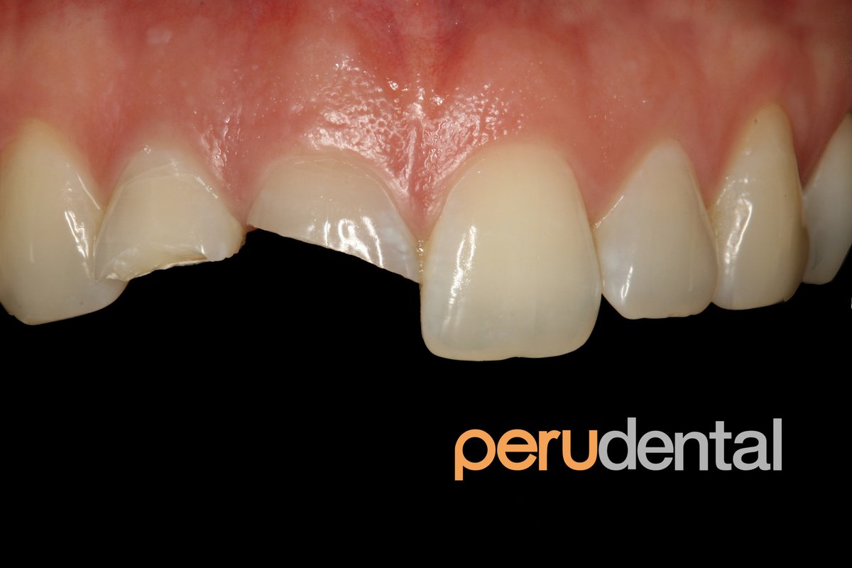 Peru Dental - Peru Dental