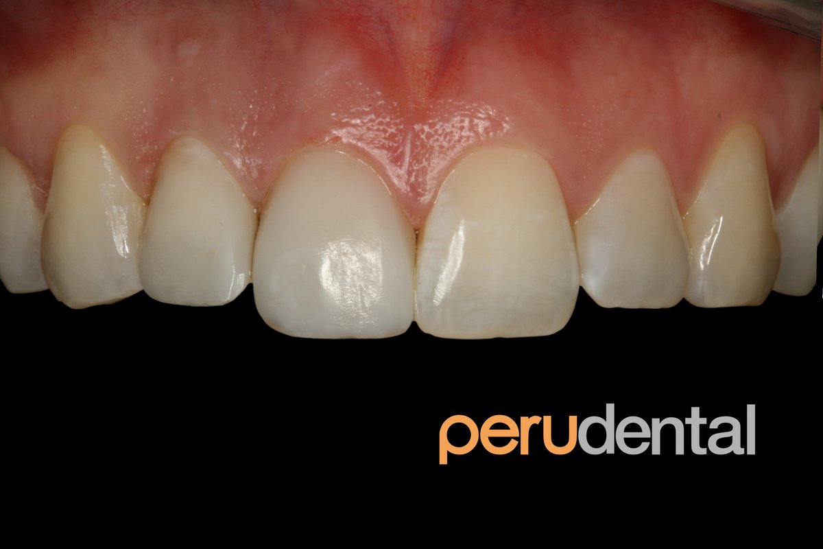 Peru Dental - Peru Dental