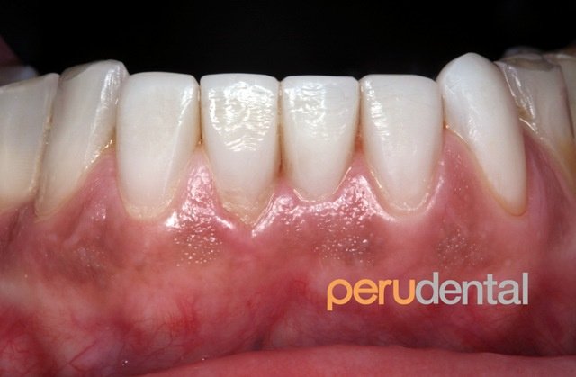 Peru Dental - Peru Dental