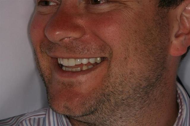 Peru Dental - Peru Dental