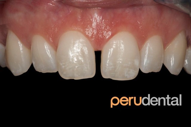 Peru Dental - Peru Dental