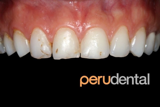 Peru Dental - Peru Dental