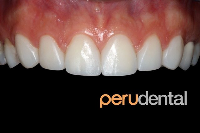 Peru Dental - Peru Dental