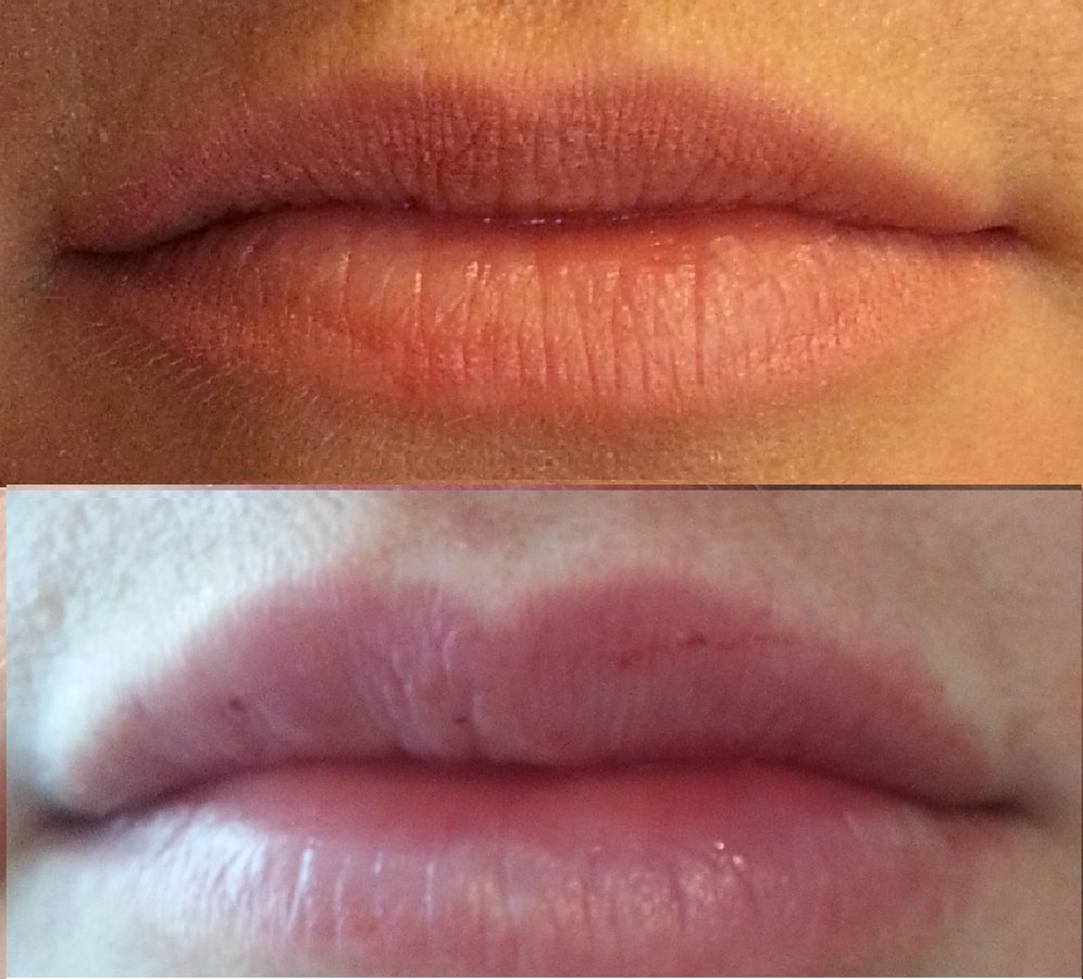 عيادة pHskin التجميلية - pHskin Cosmetic Clinic