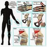 Physiotherapy Clinic - Hyderabad , Ameerpet - Physiotherapy Clinic - Hyderabad , Ameerpet