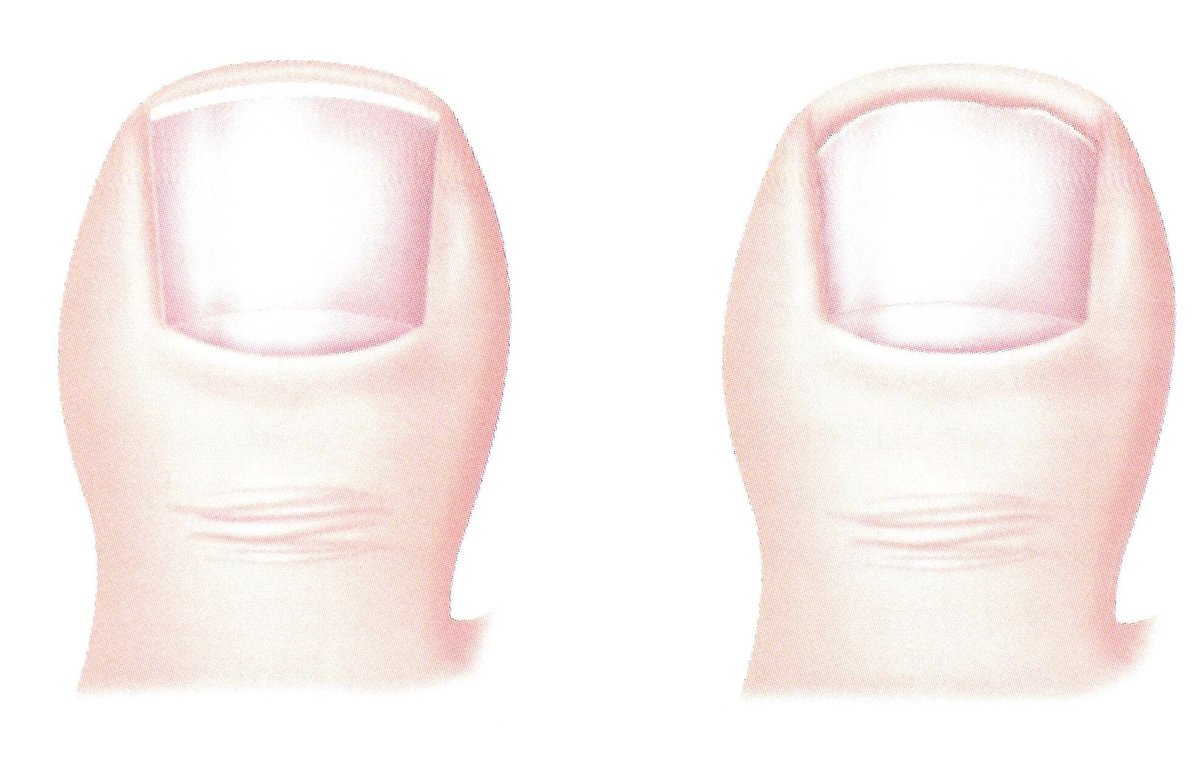 Pieter Roos - Pieter Roos