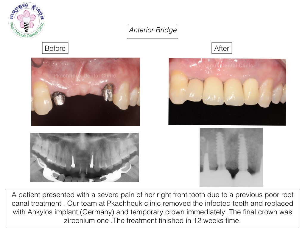 Pka Chhouk Dental Clinic - Pka Chhouk Dental Clinic