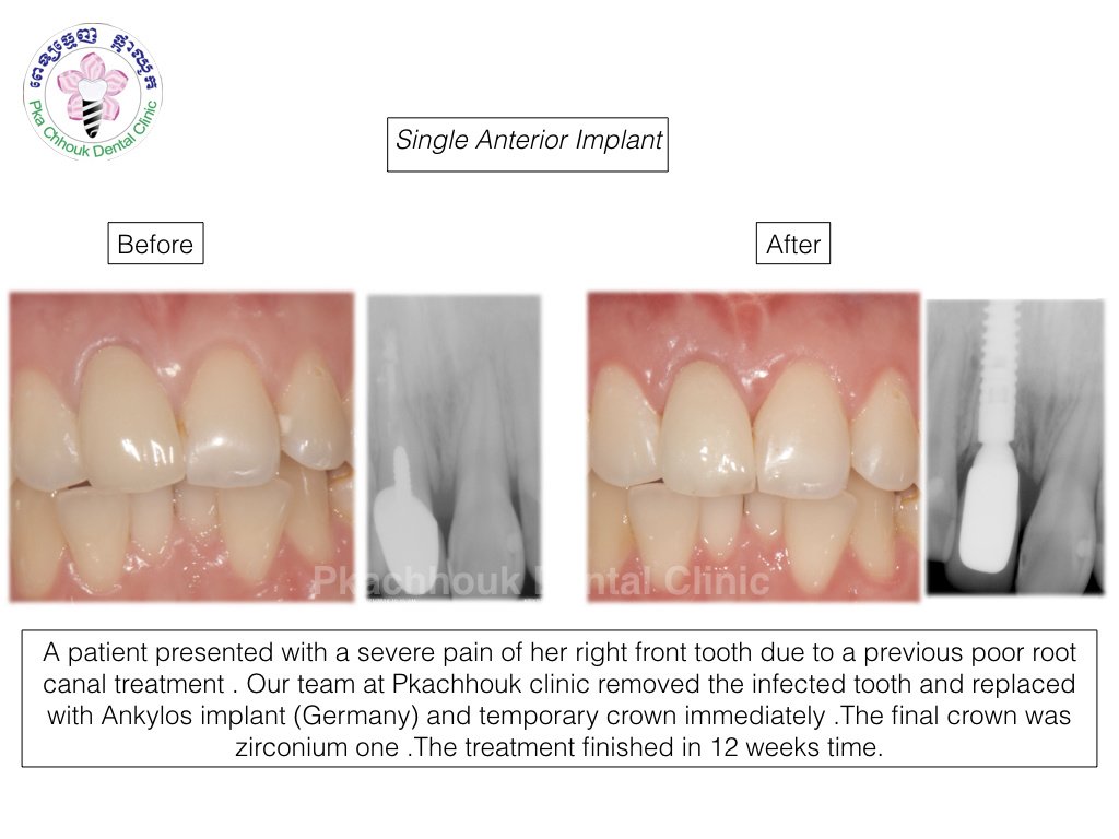 Pka Chhouk Dental Clinic - Pka Chhouk Dental Clinic