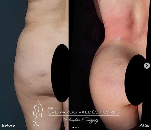 Plastic Surgery Dr Everardo Valdez - Plastic Surgery Dr Everardo Valdez