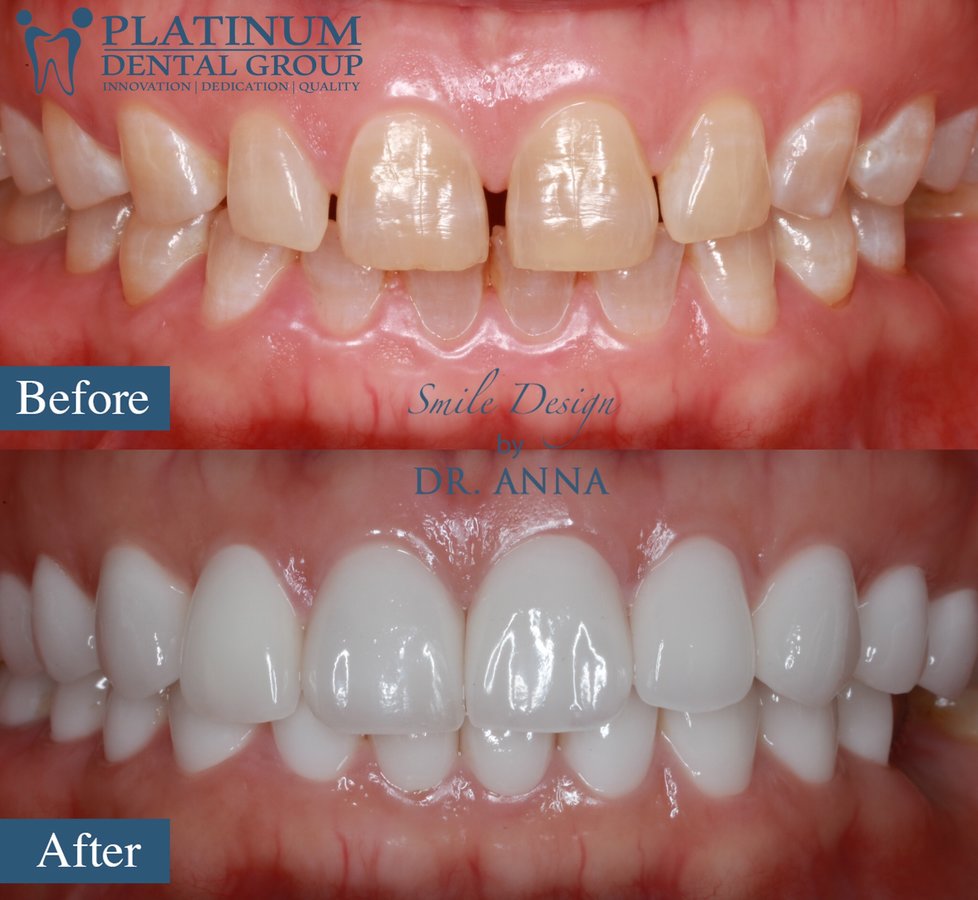 Platinum Dental Group - Platinum Dental Group