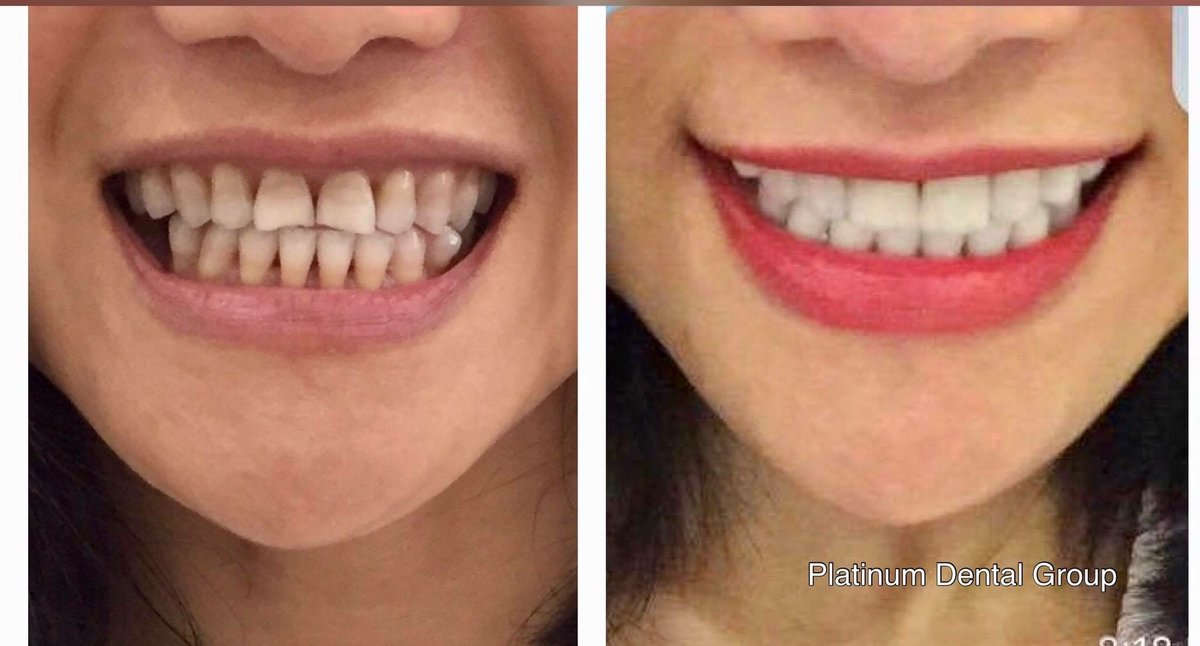 Platinum Dental Group - Platinum Dental Group