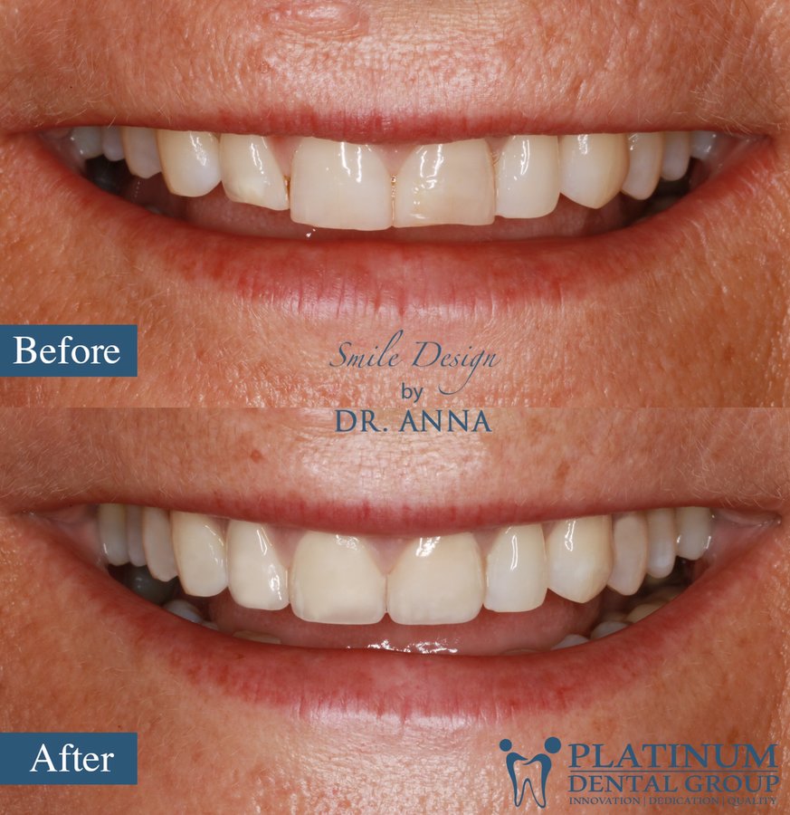 Platinum Dental Group - Platinum Dental Group