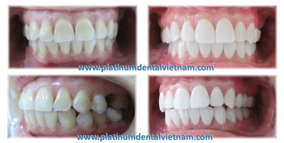 Platinum Dental Group - Platinum Dental Group