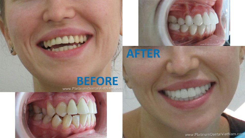 Platinum Dental Group - Platinum Dental Group