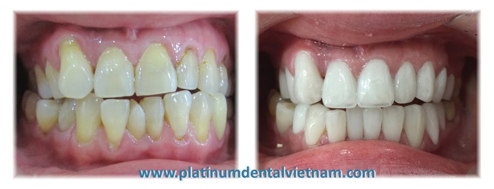 Platinum Dental Group - Platinum Dental Group