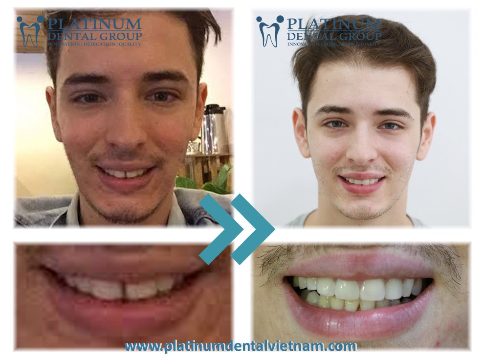 Platinum Dental Group - Platinum Dental Group
