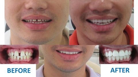 Platinum Dental Group - Platinum Dental Group