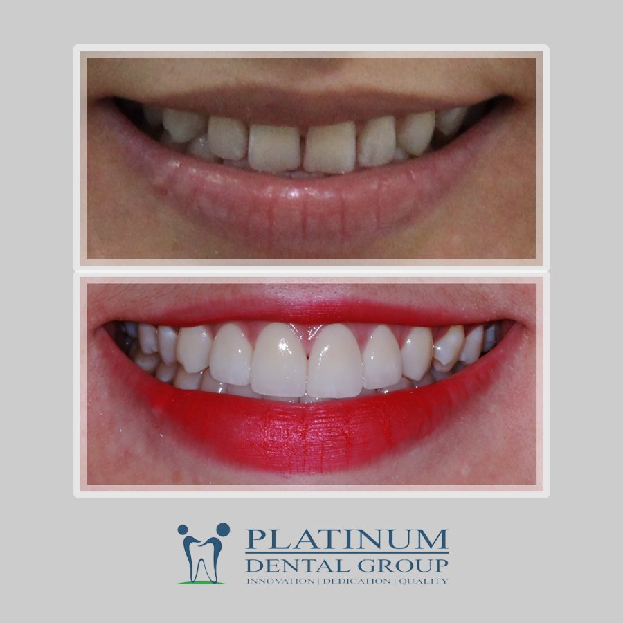 Platinum Dental Group - Platinum Dental Group