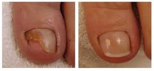 Pod Chiropody & Laser - Pod Chiropody & Laser