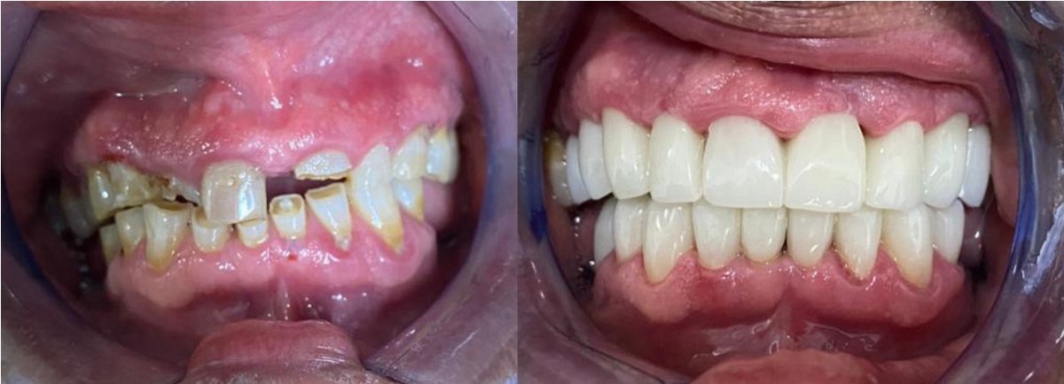 Point Dental - Point Dental