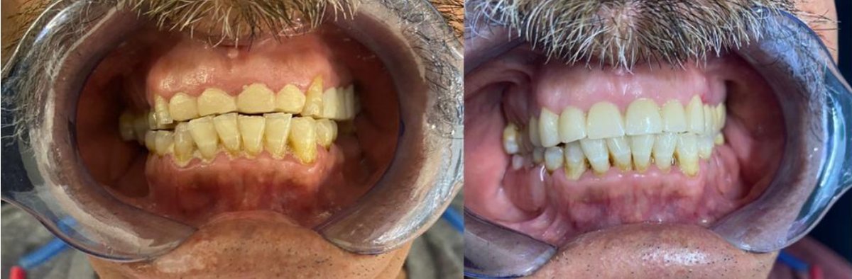 Point Dental - Point Dental