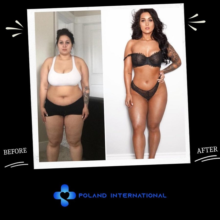 بولندا الرعاية الصحية الدولية - Poland International Health Care
