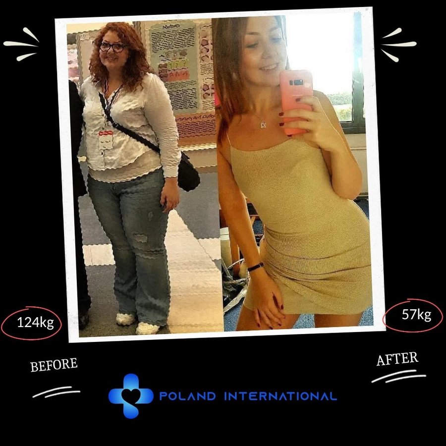 بولندا الرعاية الصحية الدولية - Poland International Health Care