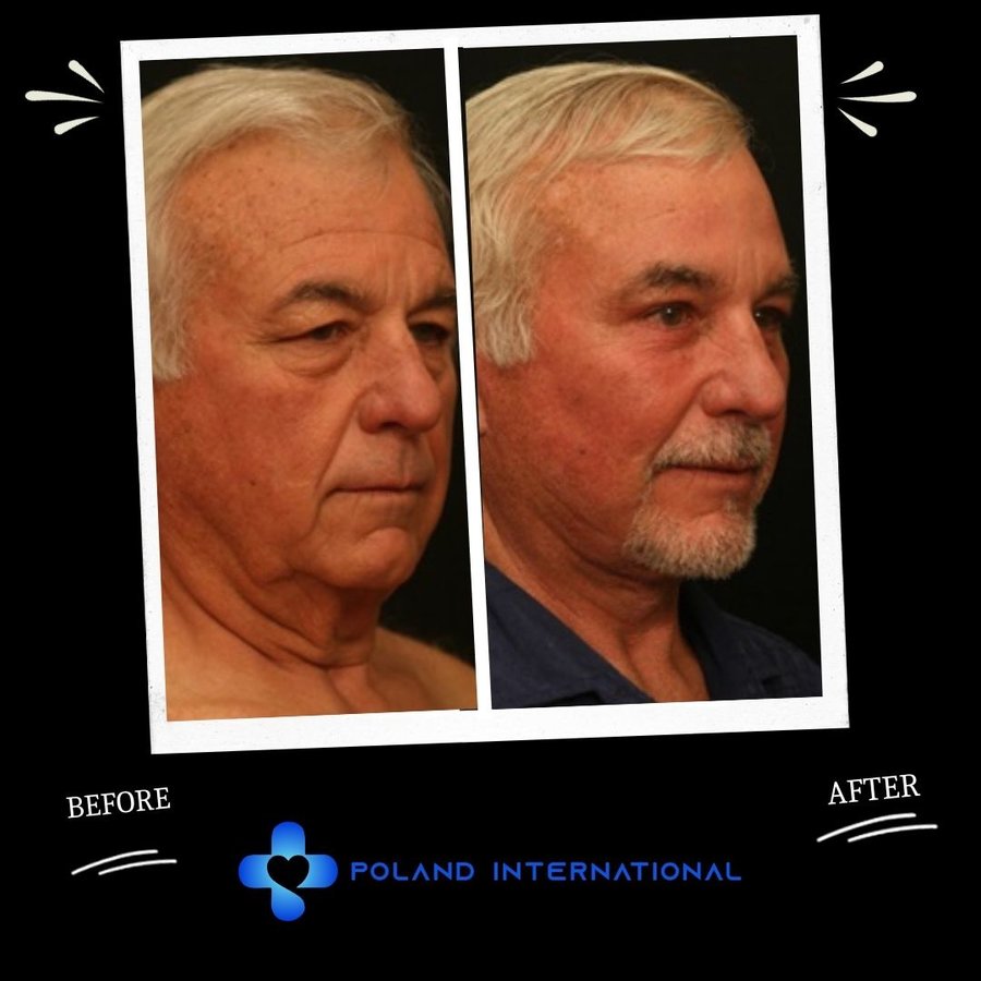 بولندا الرعاية الصحية الدولية - Poland International Health Care