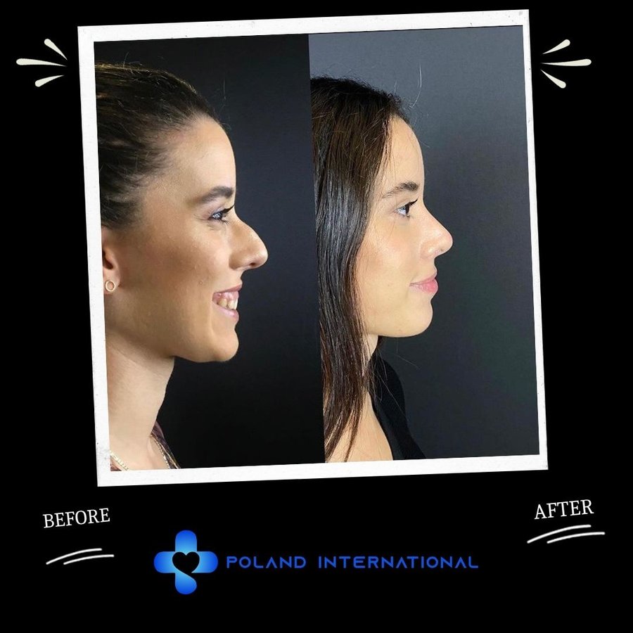 بولندا الرعاية الصحية الدولية - Poland International Health Care