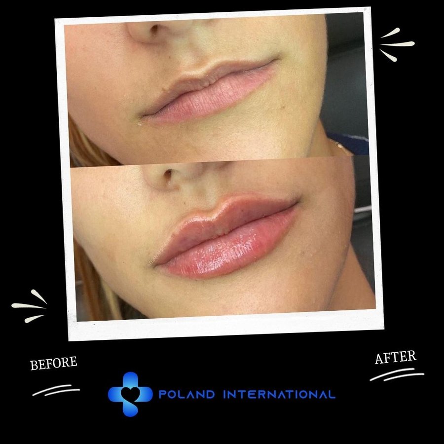بولندا الرعاية الصحية الدولية - Poland International Health Care