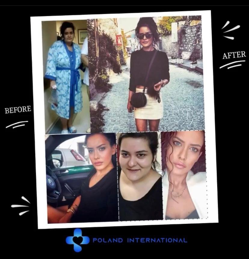 بولندا الرعاية الصحية الدولية - Poland International Health Care