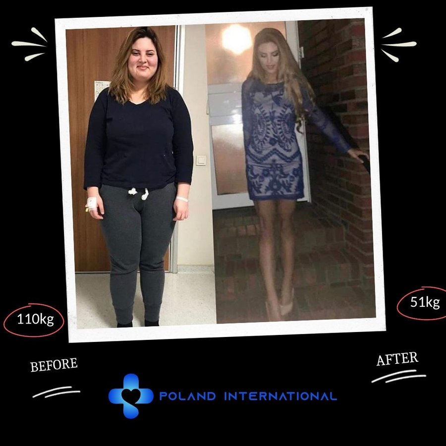 بولندا الرعاية الصحية الدولية - Poland International Health Care