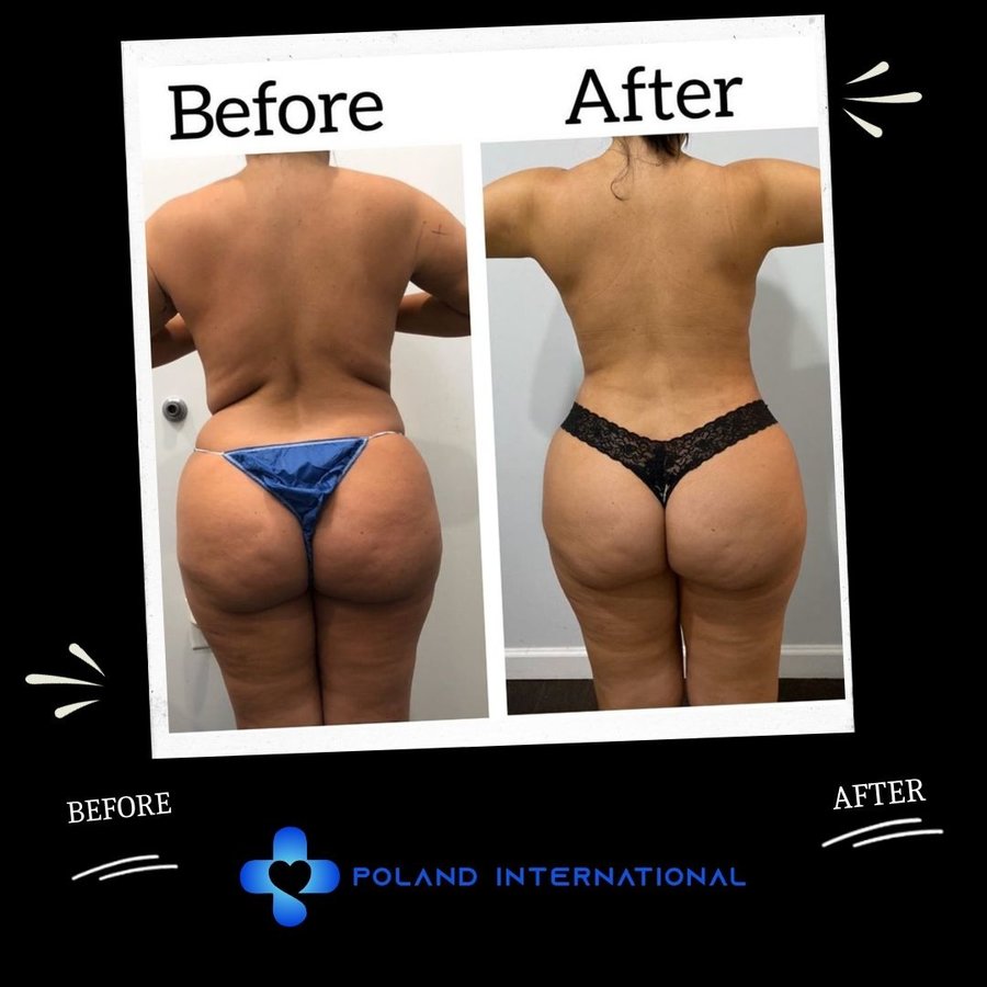 بولندا الرعاية الصحية الدولية - Poland International Health Care