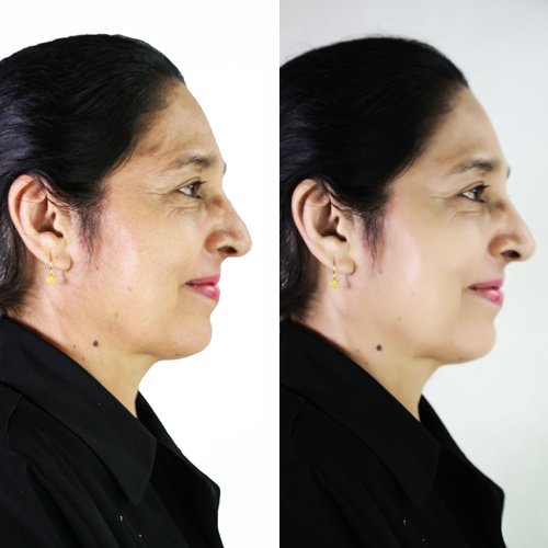 Poliklinik Chandran - Poliklinik Chandran