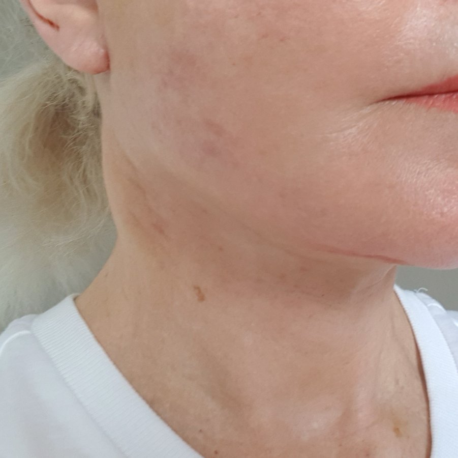 الدقة وجراحة التجميل والليزر - Precision Cosmetic and Laser Surgery