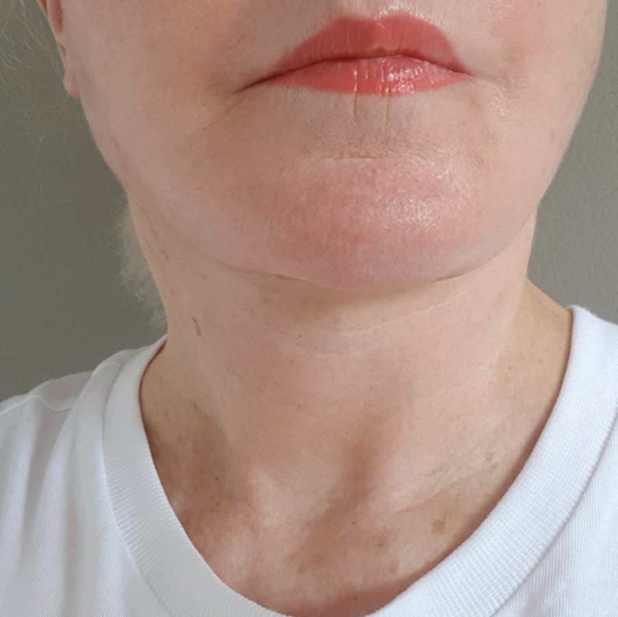 الدقة وجراحة التجميل والليزر - Precision Cosmetic and Laser Surgery